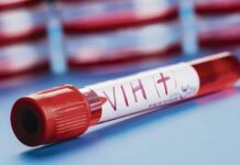 Giornata Mondiale contro l’AIDS a Reggio Emilia: “Una battaglia che riguarda la salute e i diritti umani”